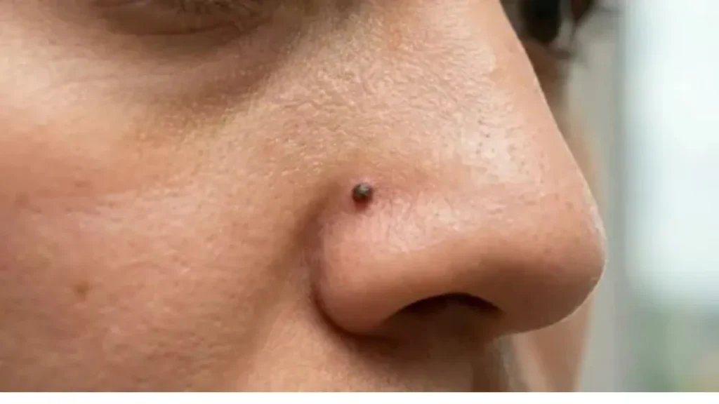 Nose-Mole-Meaning-Females_V_jpg--1280x720-4g